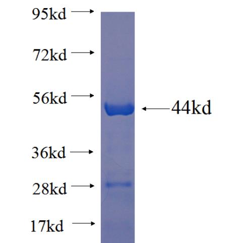 Recombinant human GRP94 SDS-PAGE