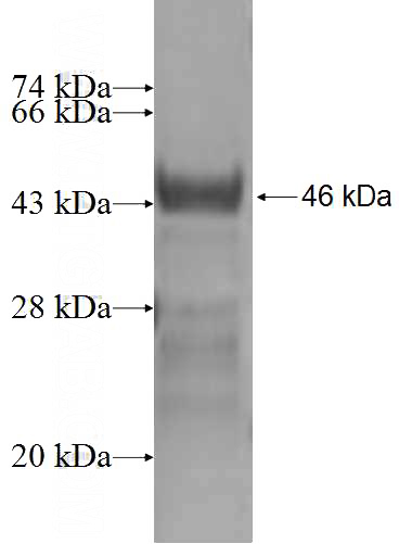 Recombinant Human VPS37A SDS-PAGE