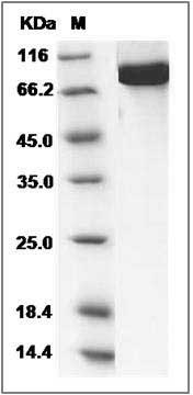 Human ALOX15B / 15 Lipoxygenase 2 Protein (His & GST Tag) SDS-PAGE