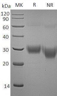 Human FCGR2A/CD32/FCG2/FCGR2A1/IGFR2 (His tag) recombinant protein
