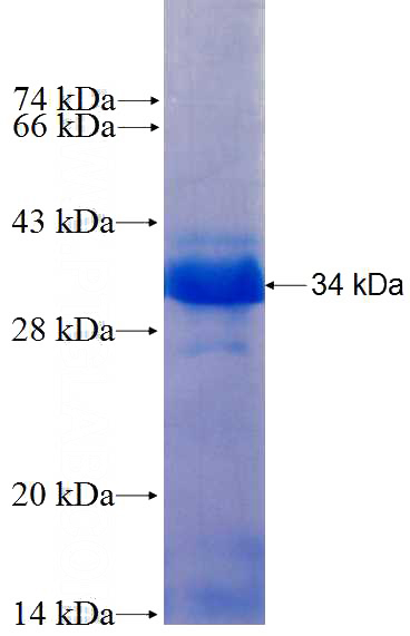 Recombinant Human SNAI1 SDS-PAGE