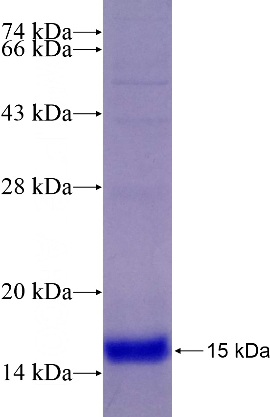 Recombinant Human UQCRQ SDS-PAGE