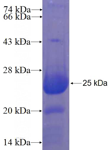Recombinant Human MTMR7 SDS-PAGE