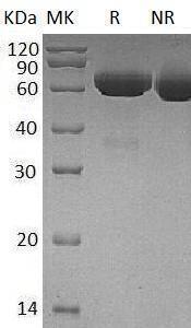 Human PLAT (His tag) recombinant protein