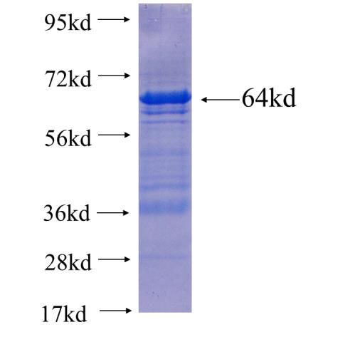 Recombinant human ACSL1 SDS-PAGE