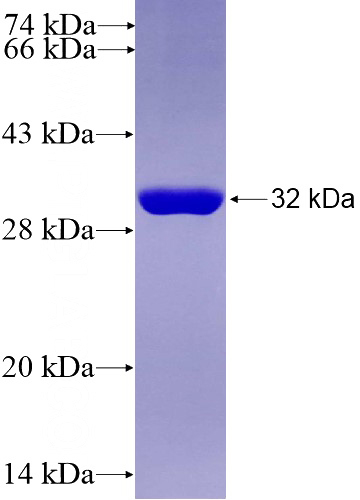 Recombinant Human PKP3 SDS-PAGE