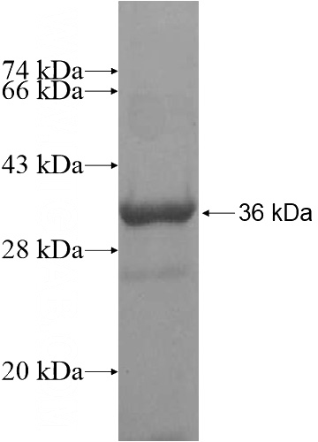 Recombinant Human WDR37 SDS-PAGE