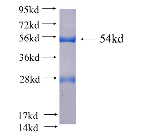 Recombinant human PLEK2 SDS-PAGE