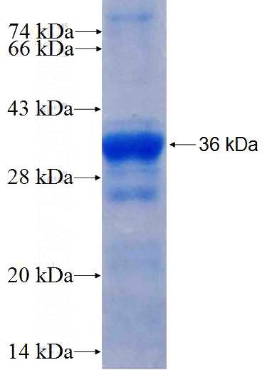 Recombinant Human PTPRN2 SDS-PAGE