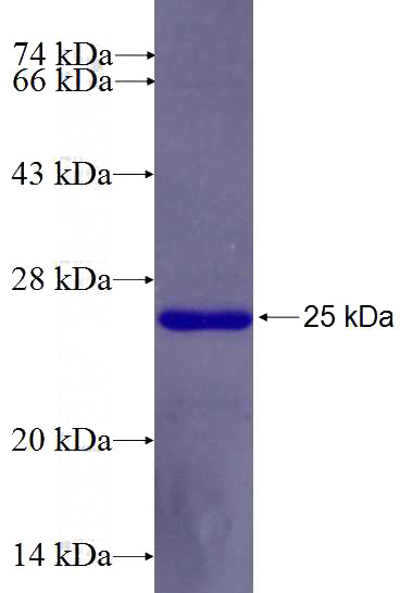 Recombinant Human SAP30 SDS-PAGE