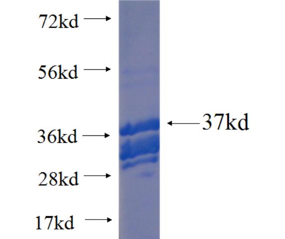 Recombinant human ZNF251 SDS-PAGE