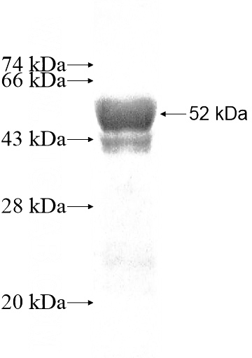 Recombinant Human RAB33B SDS-PAGE
