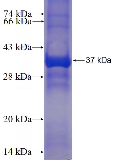 Recombinant Human ATG9A SDS-PAGE