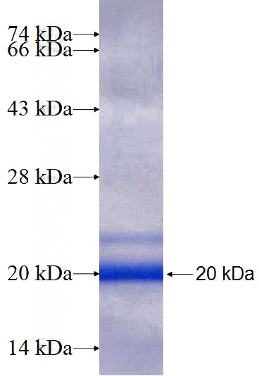 Recombinant Human RPS25 SDS-PAGE