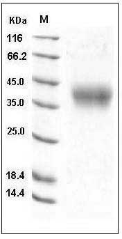 Mouse 4-1BBL / CD137L / TNFSF9 Protein (His Tag) SDS-PAGE