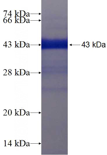 Recombinant Human C2orf67 SDS-PAGE