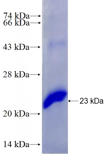Recombinant Human CD18 SDS-PAGE