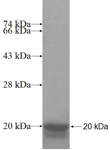 Recombinant Human SLC30A2 SDS-PAGE
