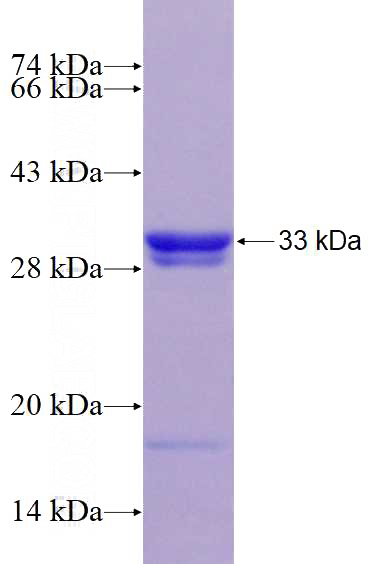 Recombinant Human ABCB10 SDS-PAGE