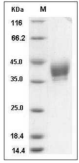 Mouse CD33 / Siglec-3 Protein (His Tag) SDS-PAGE