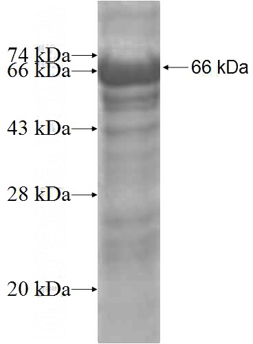 Recombinant Human MAPK8IP2 SDS-PAGE