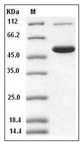 Mouse CES2 / Carboxylesterase-2 Protein (His Tag) SDS-PAGE