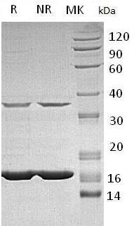 Human IFNA2/IFNA2A/IFNA2B/IFNA2C recombinant protein
