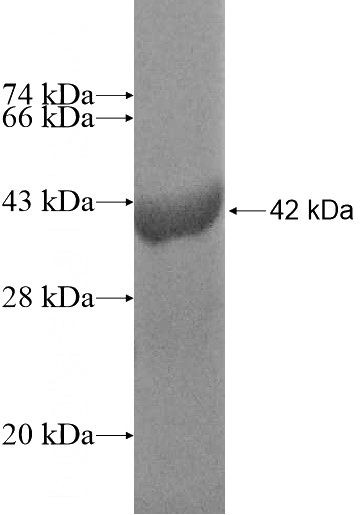 Recombinant Human LRRN1 SDS-PAGE