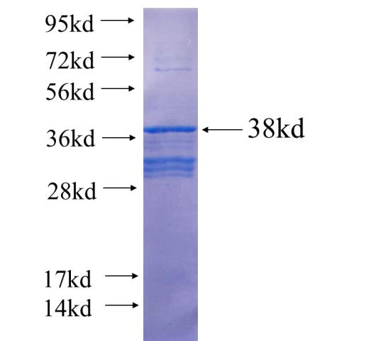 Recombinant human PPARG SDS-PAGE
