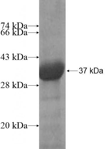 Recombinant Human KCTD10 SDS-PAGE