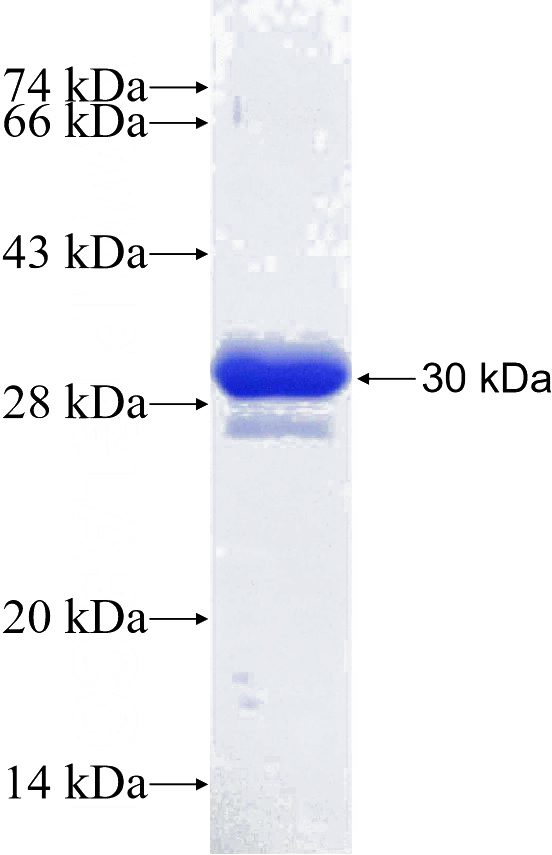 Recombinant Human GFRAL SDS-PAGE