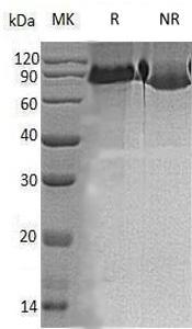 Human CD93/C1QR1/MXRA4 (His tag) recombinant protein