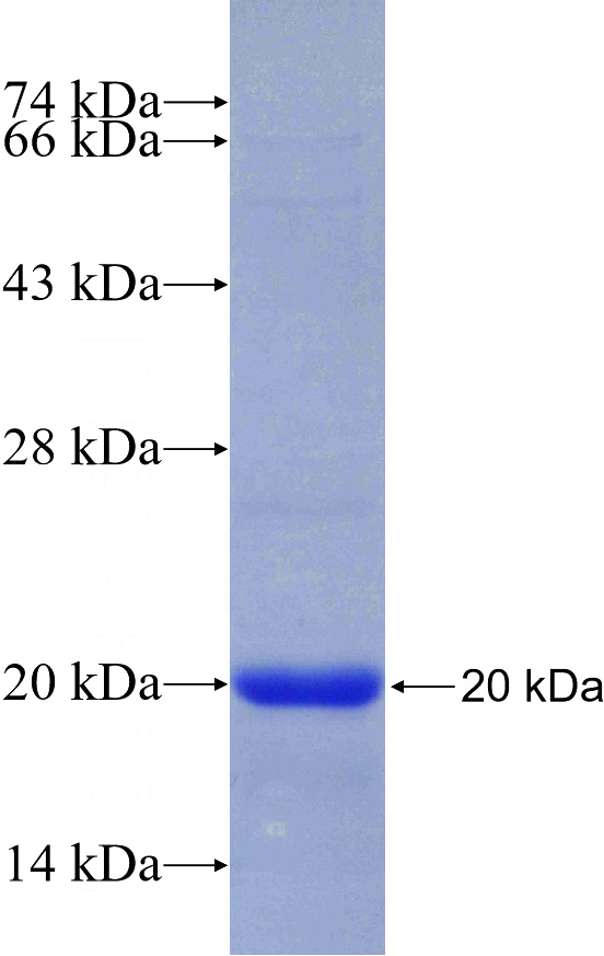 Recombinant Human CSDA SDS-PAGE