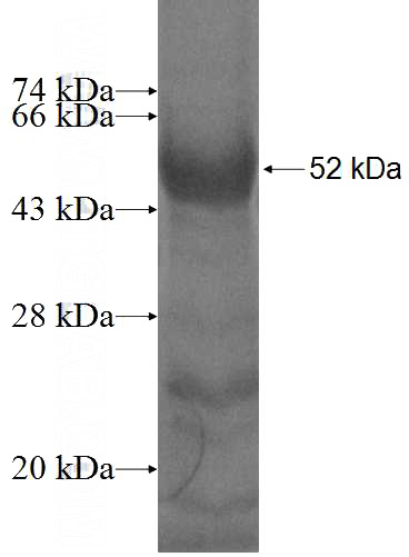 Recombinant Human PIGA SDS-PAGE