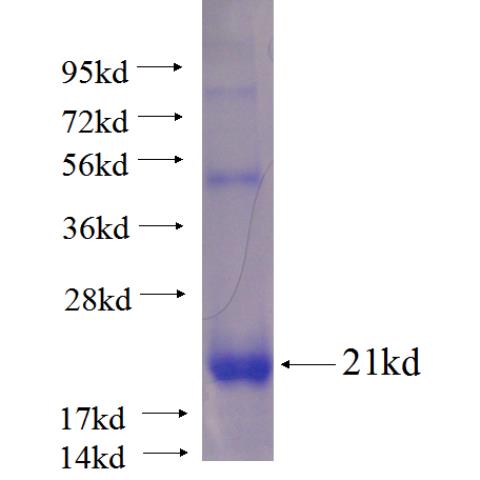 Recombinant human EDA SDS-PAGE