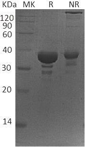 Human SGTA/SGT/SGT1 (His tag) recombinant protein