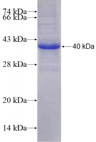 Recombinant Human ALG2 SDS-PAGE
