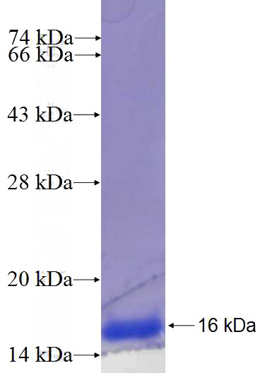 Recombinant Human ITIH2 SDS-PAGE
