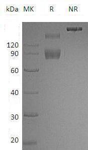 Mouse Il1r2/Il-1r2/Il1rb (Fc tag) recombinant protein