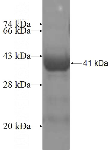 Recombinant Human DHDH SDS-PAGE