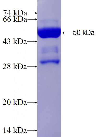 Recombinant Human MARCO SDS-PAGE