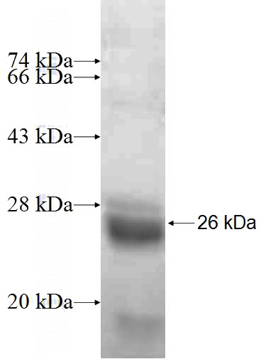 Recombinant Human RABL4 SDS-PAGE