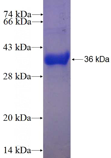 Recombinant Human ELAC1 SDS-PAGE