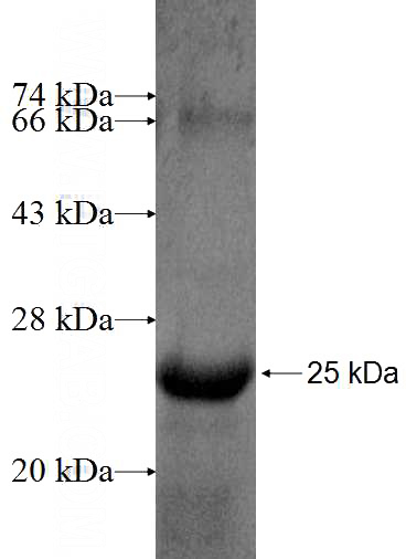 Recombinant Human THYN1 SDS-PAGE