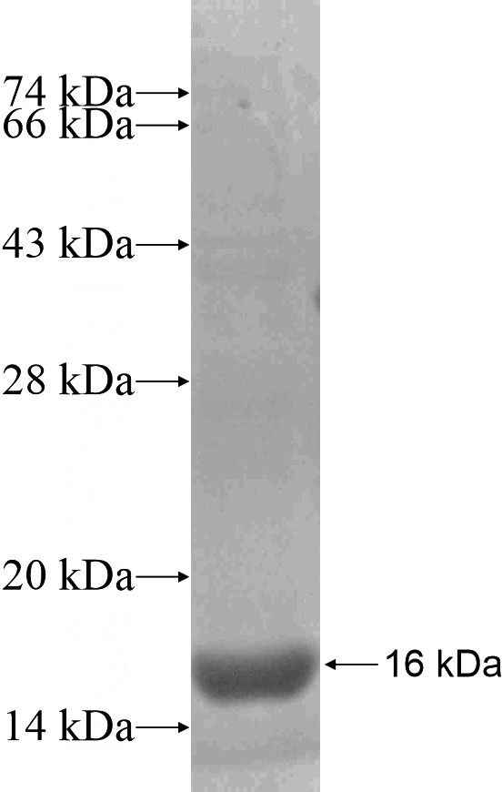 Recombinant Human MOGAT3 SDS-PAGE