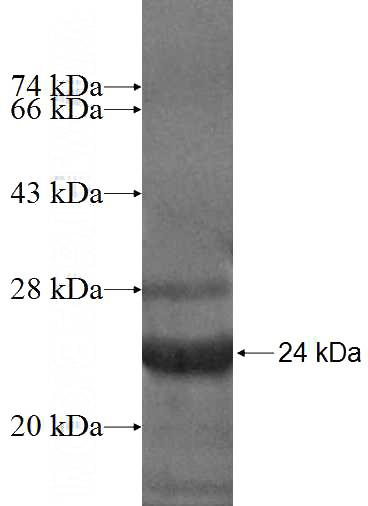 Recombinant Human CCDC28A SDS-PAGE
