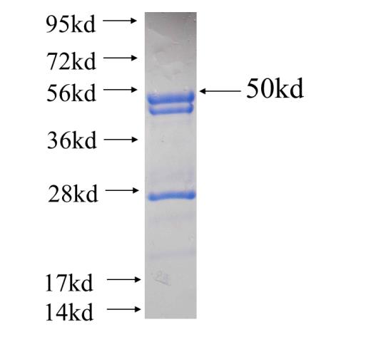 Recombinant human RAB3D SDS-PAGE