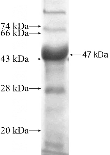 Recombinant Human CDON SDS-PAGE