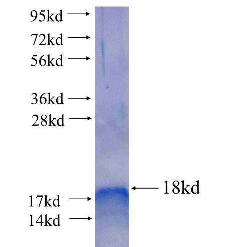 Recombinant human FSD1L SDS-PAGE