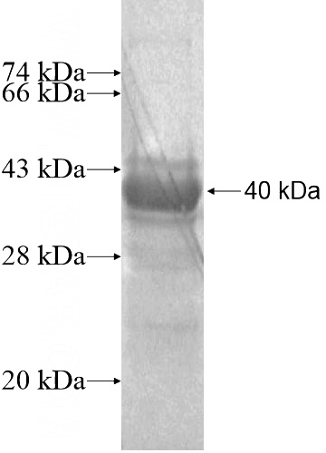 Recombinant Human KRT222P SDS-PAGE